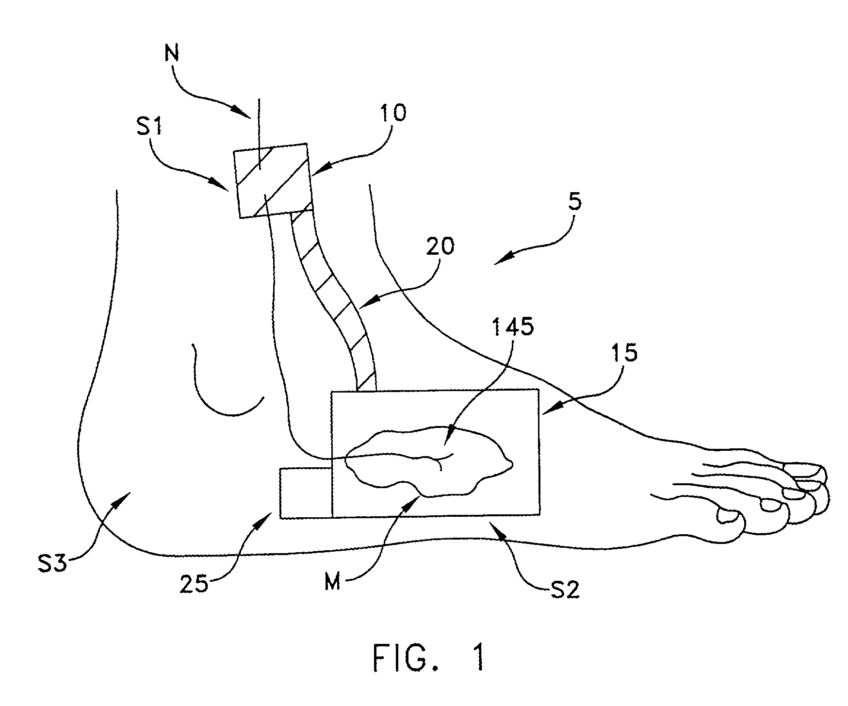 Apparatus and method for performing nerve conduction studies with localization of evoked responses