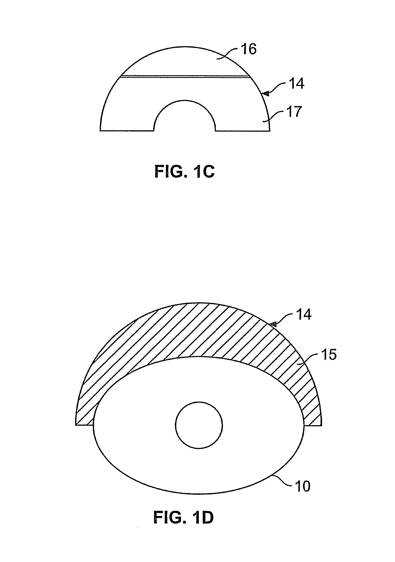 Adhesively Supporting a Breastshield