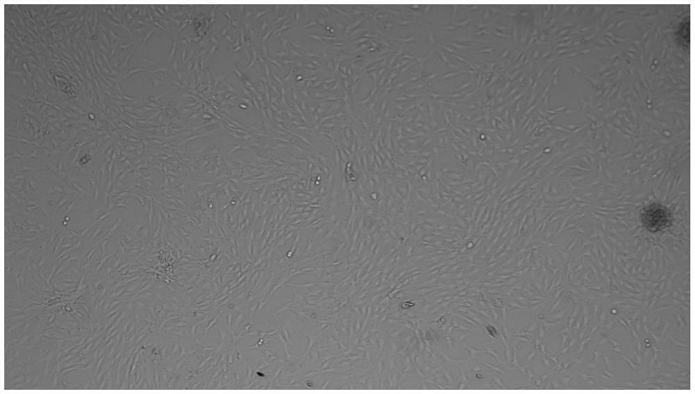 A method for preserving adipose tissue, adipose tissue preservation solution and preparation method thereof