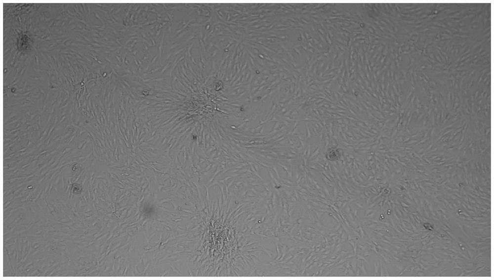 A method for preserving adipose tissue, adipose tissue preservation solution and preparation method thereof