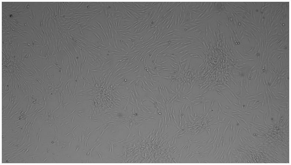 A method for preserving adipose tissue, adipose tissue preservation solution and preparation method thereof