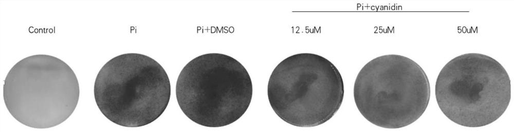 Application of cyanidin in prevention and treatment of vascular calcification