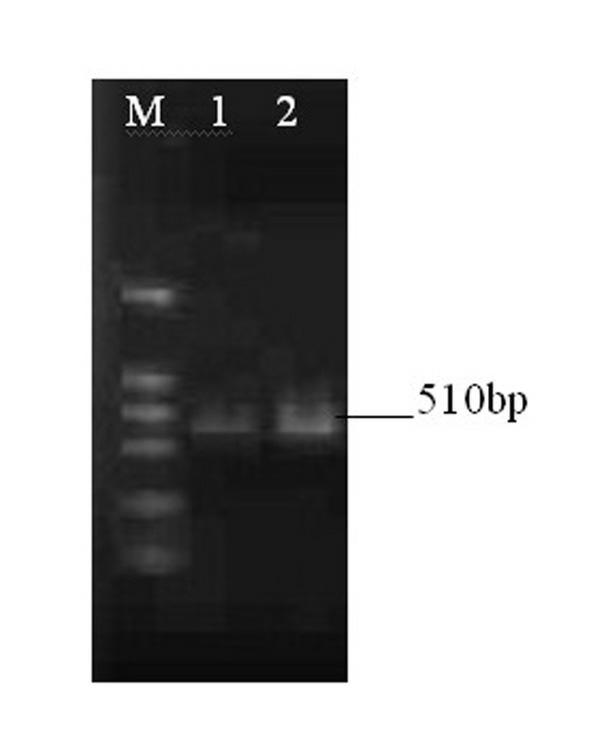 Jujube glutathione peroxidase gene