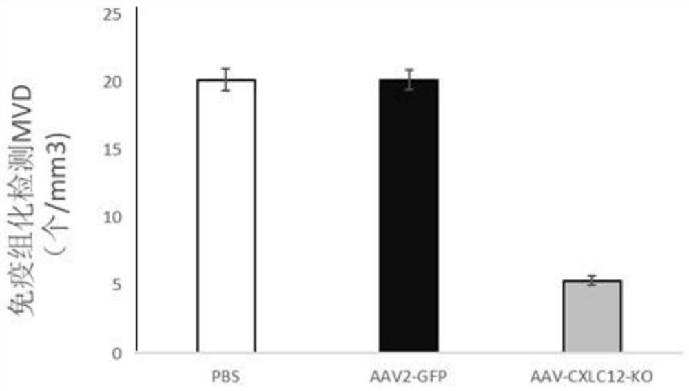 Adeno-associated virus recombinant vector for knocking out CXCL12 gene and its construction method and application