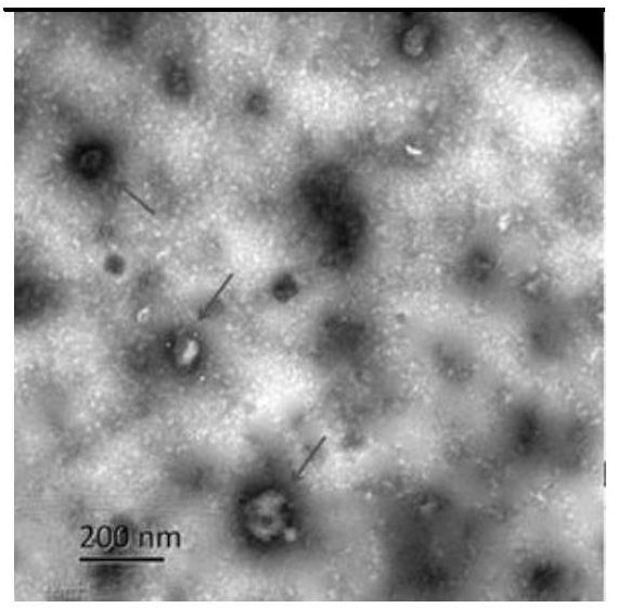 Glioma cell exosomes containing mir-124 and preparation method and application thereof