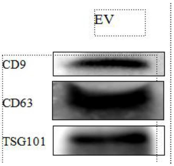 Glioma cell exosomes containing mir-124 and preparation method and application thereof