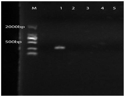 Specific primer, kit and method for qualitatively and/or quantitatively detecting lactobacillus rhamnosus