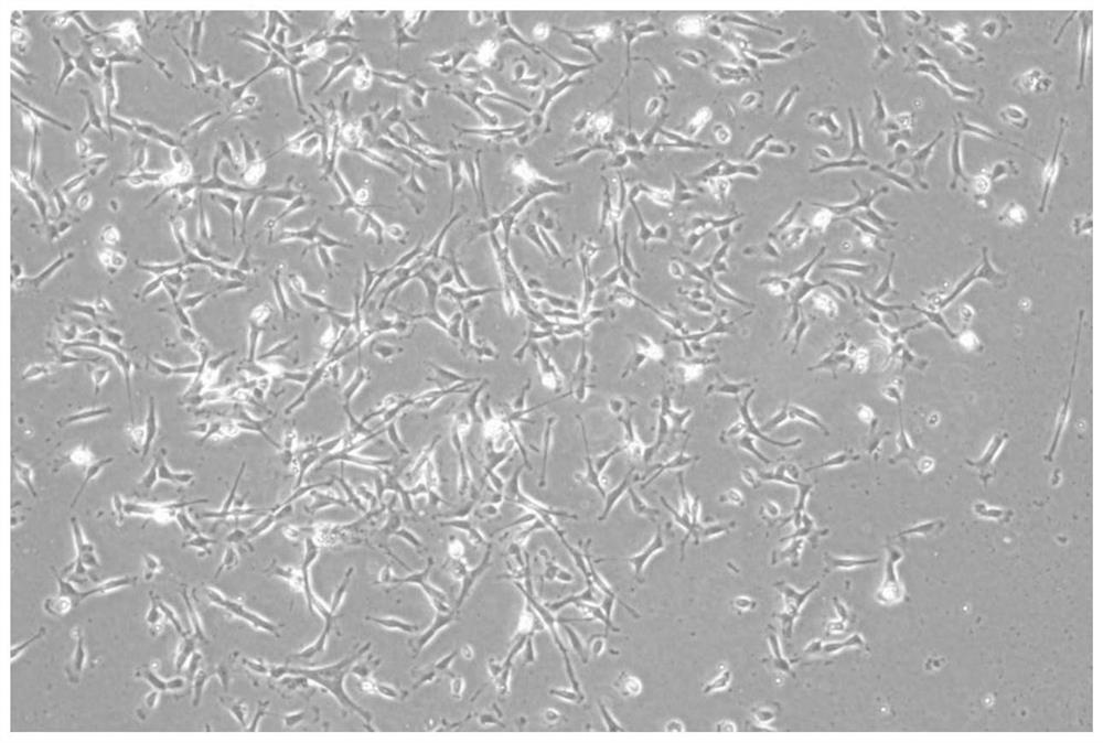 Human umbilical cord mesenchymal stem cell culture medium, human umbilical cord mesenchymal stem cell injection, preparation method and application of human umbilical cord mesenchymal stem cell injection in preparation of medicine for treating cerebral apoplexy