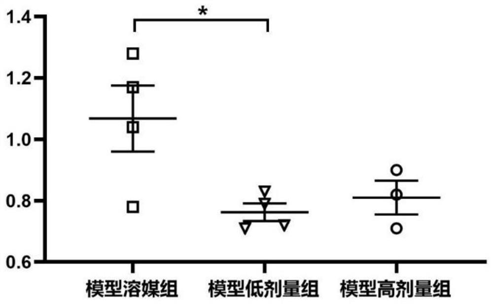 Human umbilical cord mesenchymal stem cell culture medium, human umbilical cord mesenchymal stem cell injection, preparation method and application of human umbilical cord mesenchymal stem cell injection in preparation of medicine for treating cerebral apoplexy