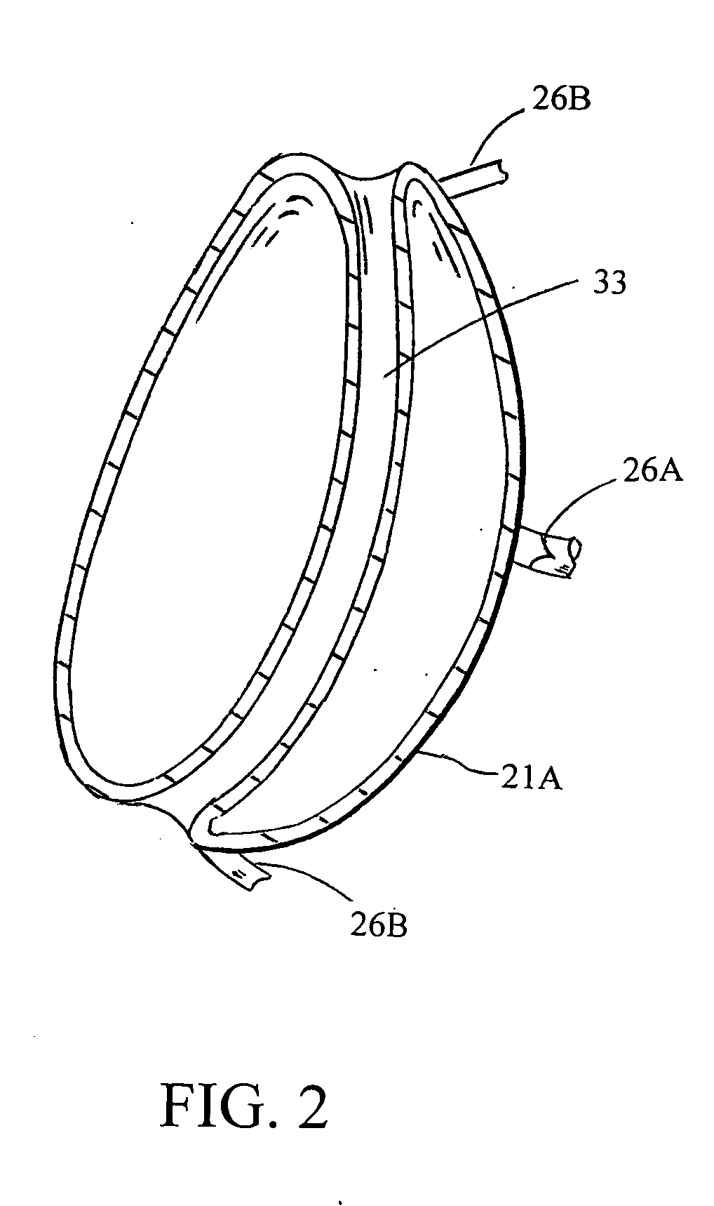 Intragastric space filler