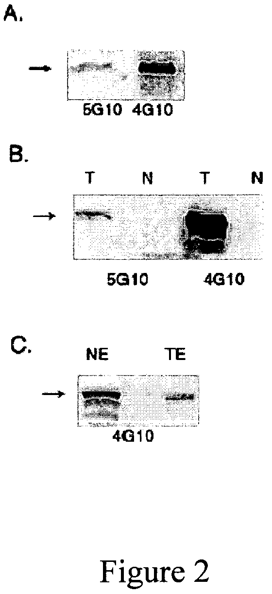 Hybridoma cell lines and monoclonal antibodies recognizing Prox1