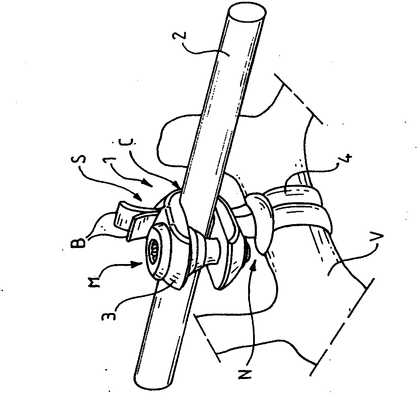 Vertebral fixation device