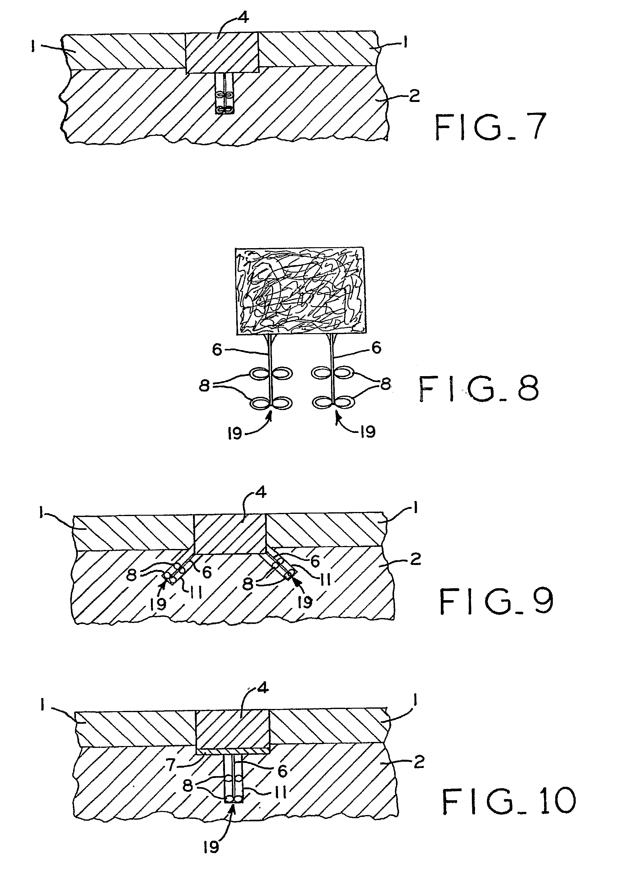 Articular Cartilage Fixation Device and Method