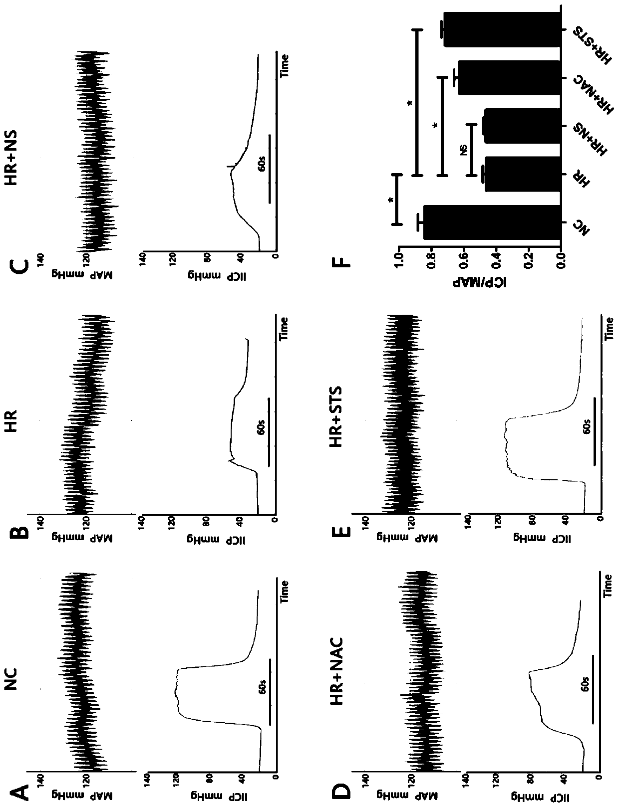 Application of sodium tanshinone ⅱa sulfonate in the preparation of drugs for treating erectile dysfunction