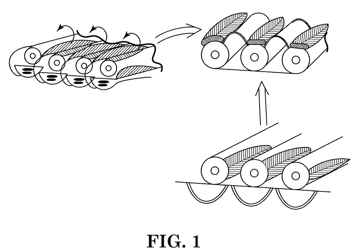 Myoelectric prosthesis and method