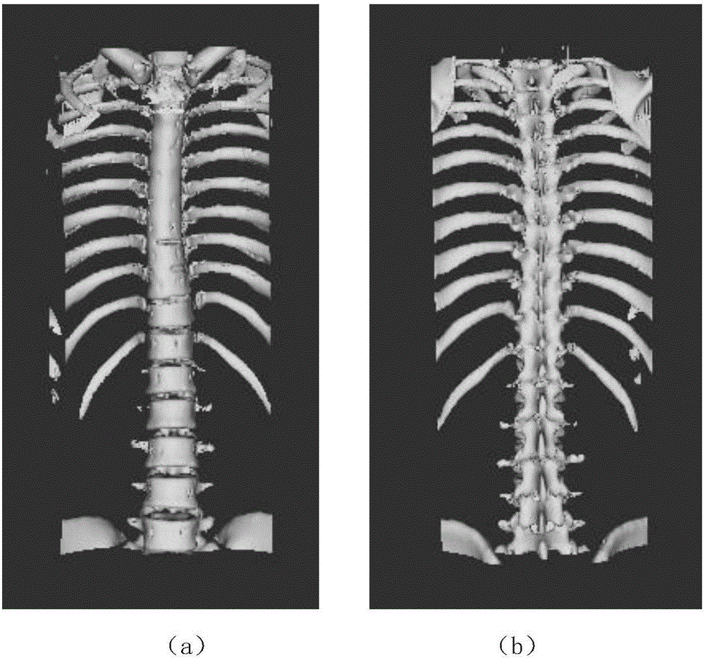 Spine feature point automatic recognizing method based on average curvature flow