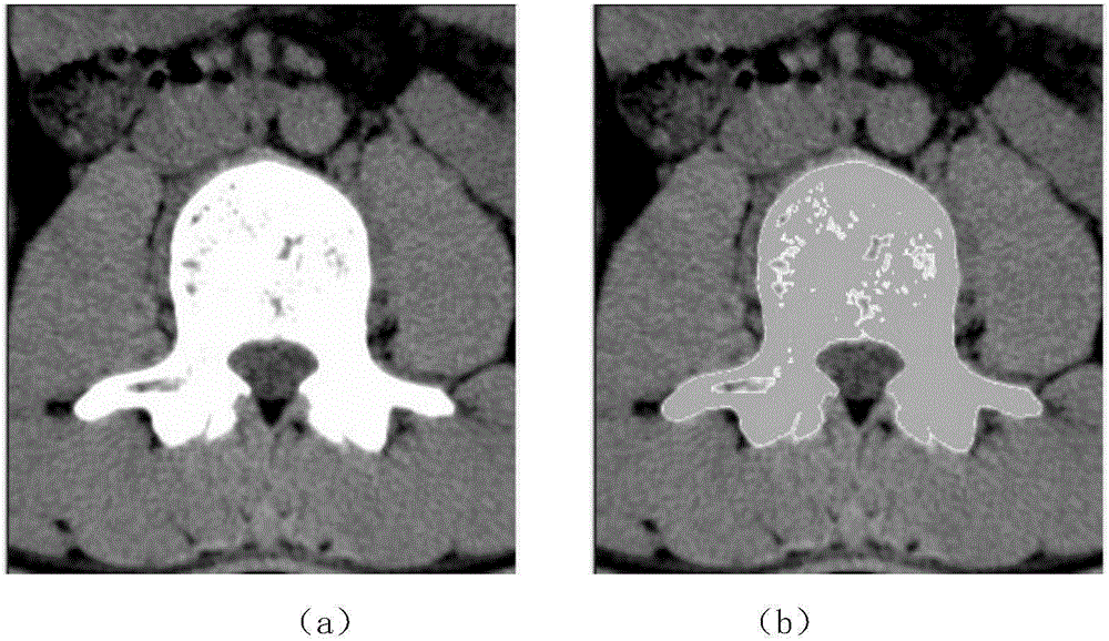 Spine feature point automatic recognizing method based on average curvature flow