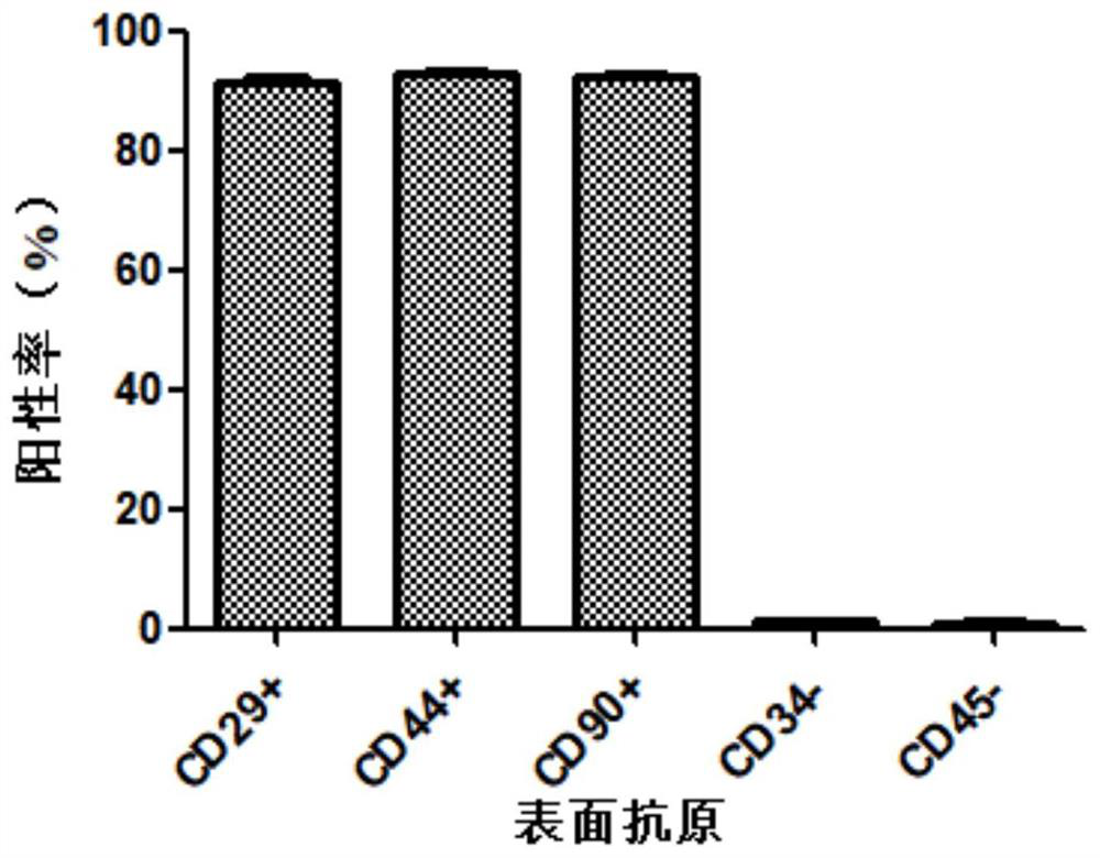 Human adipose mesenchymal stem cell exosome with high expression of IL-10 for treating myocardial infarction and use of exosome