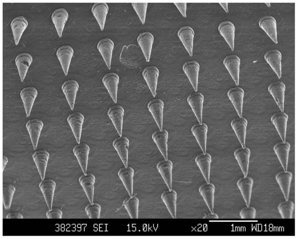 Soluble microneedle patch and preparation method thereof