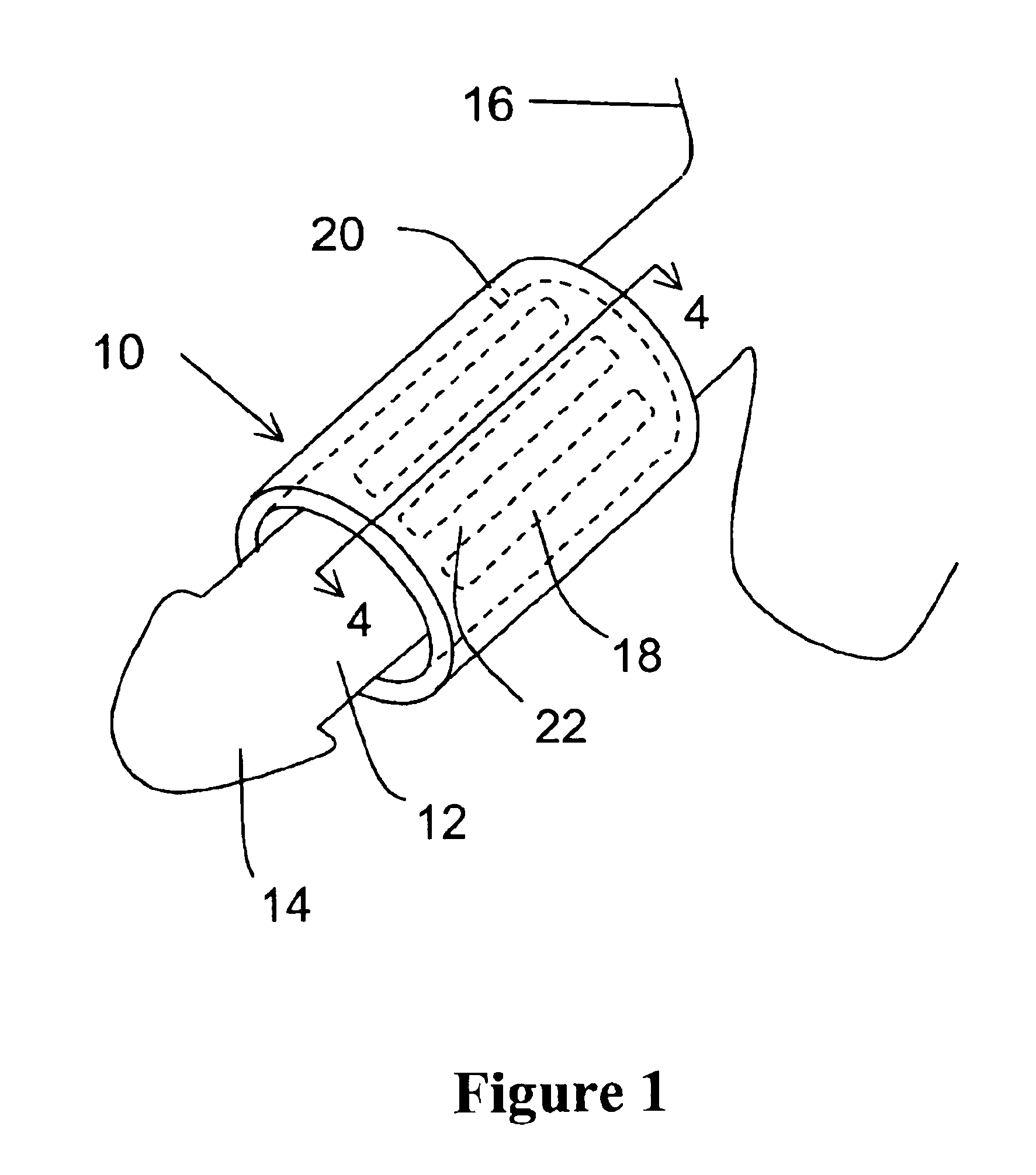 Urinary incontinence control device and method of use