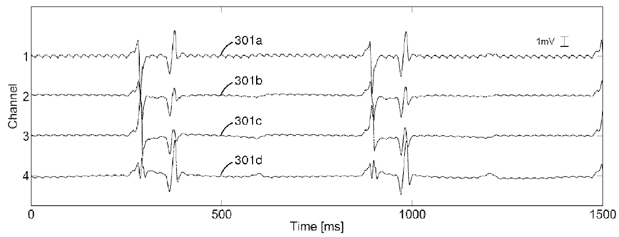 System and method for processing signals from intracardiac catheters