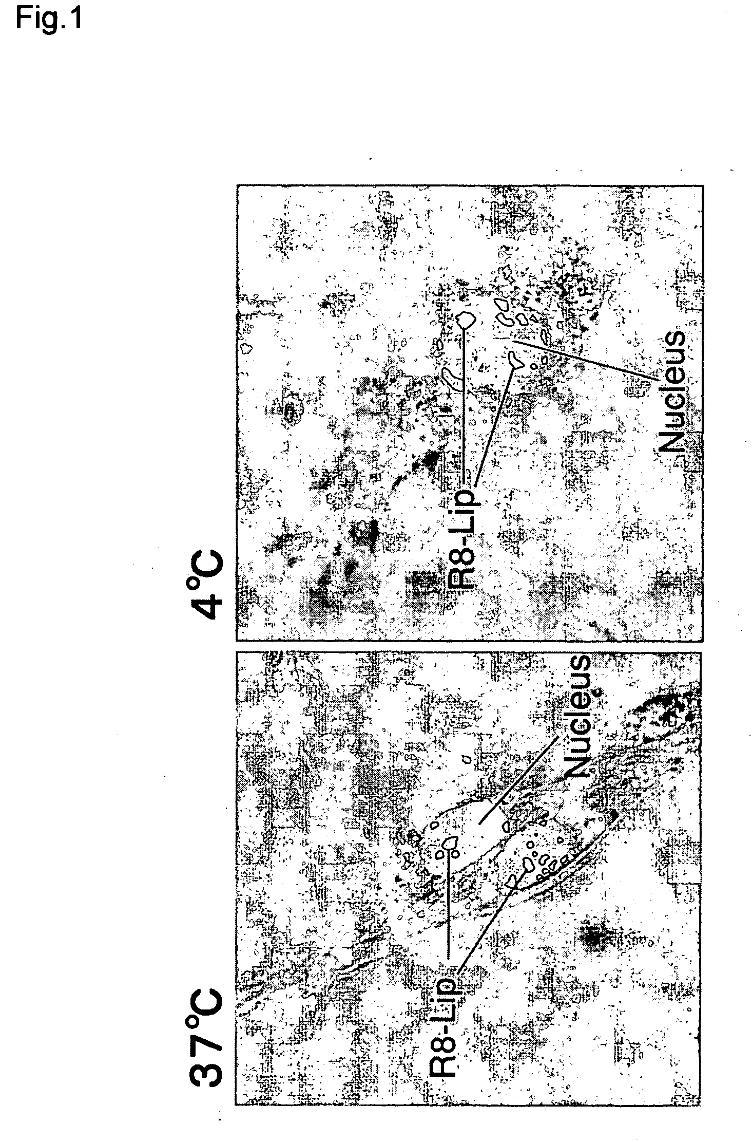 Polyarginine-modified liposome having nuclear entry ability