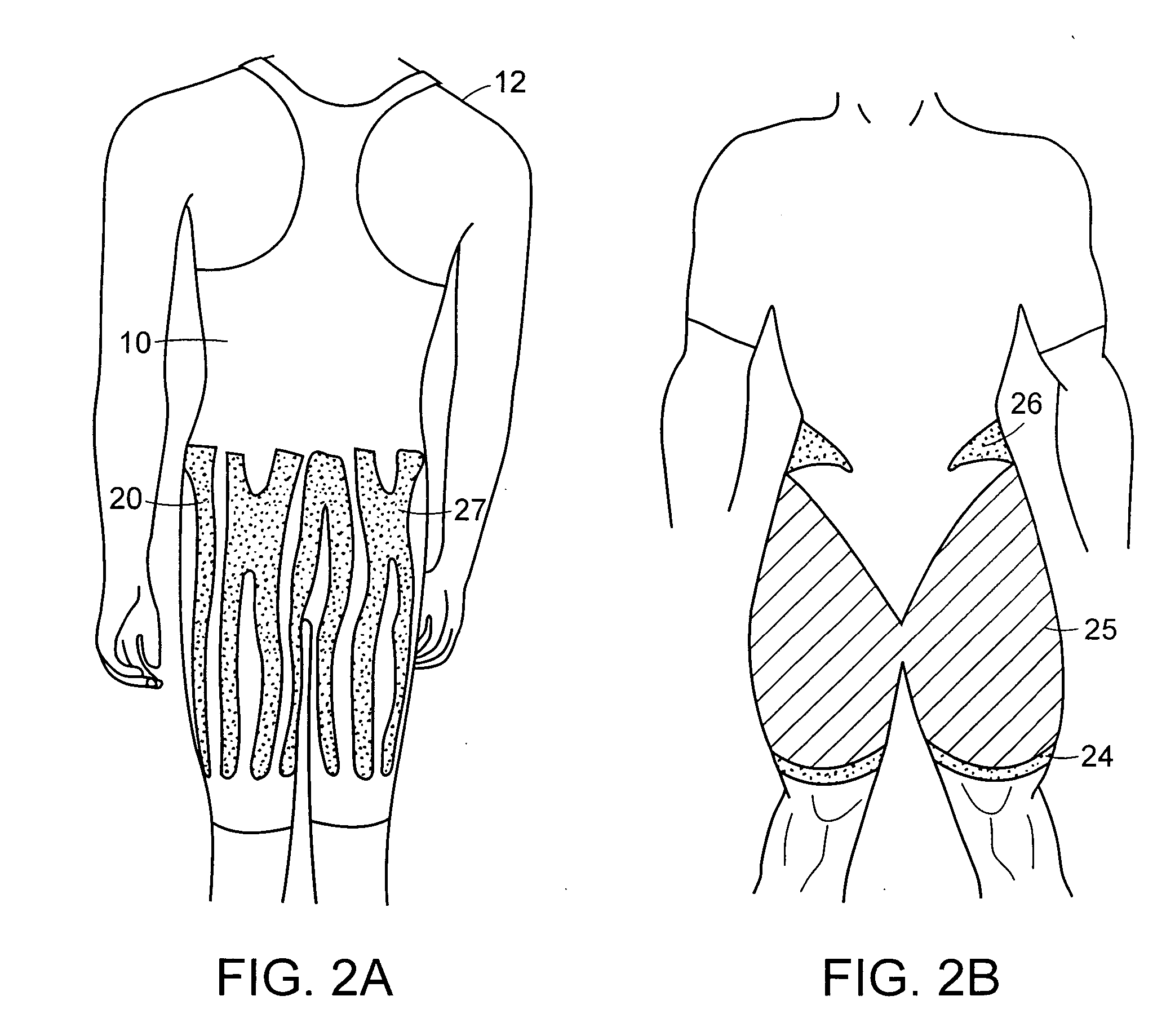 Garment