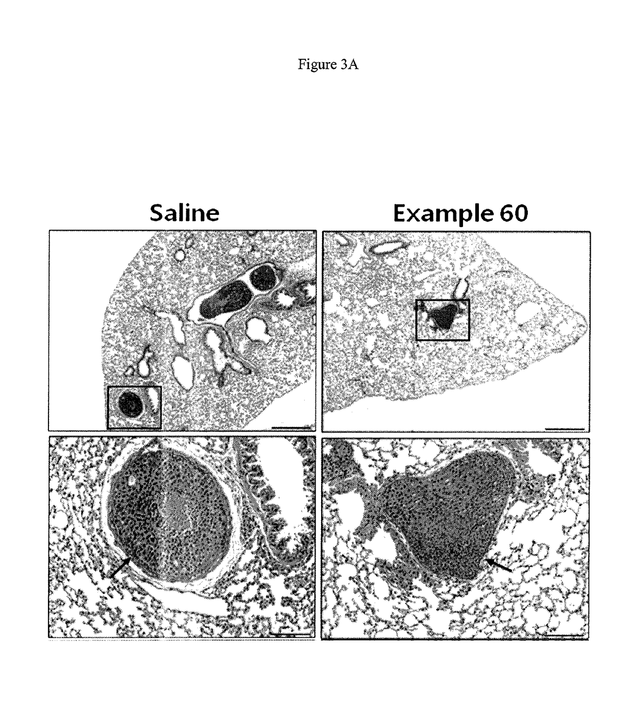 2-pyridyl substituted imidazoles as therapeutic ALK5 and/or ALK4 inhibitors