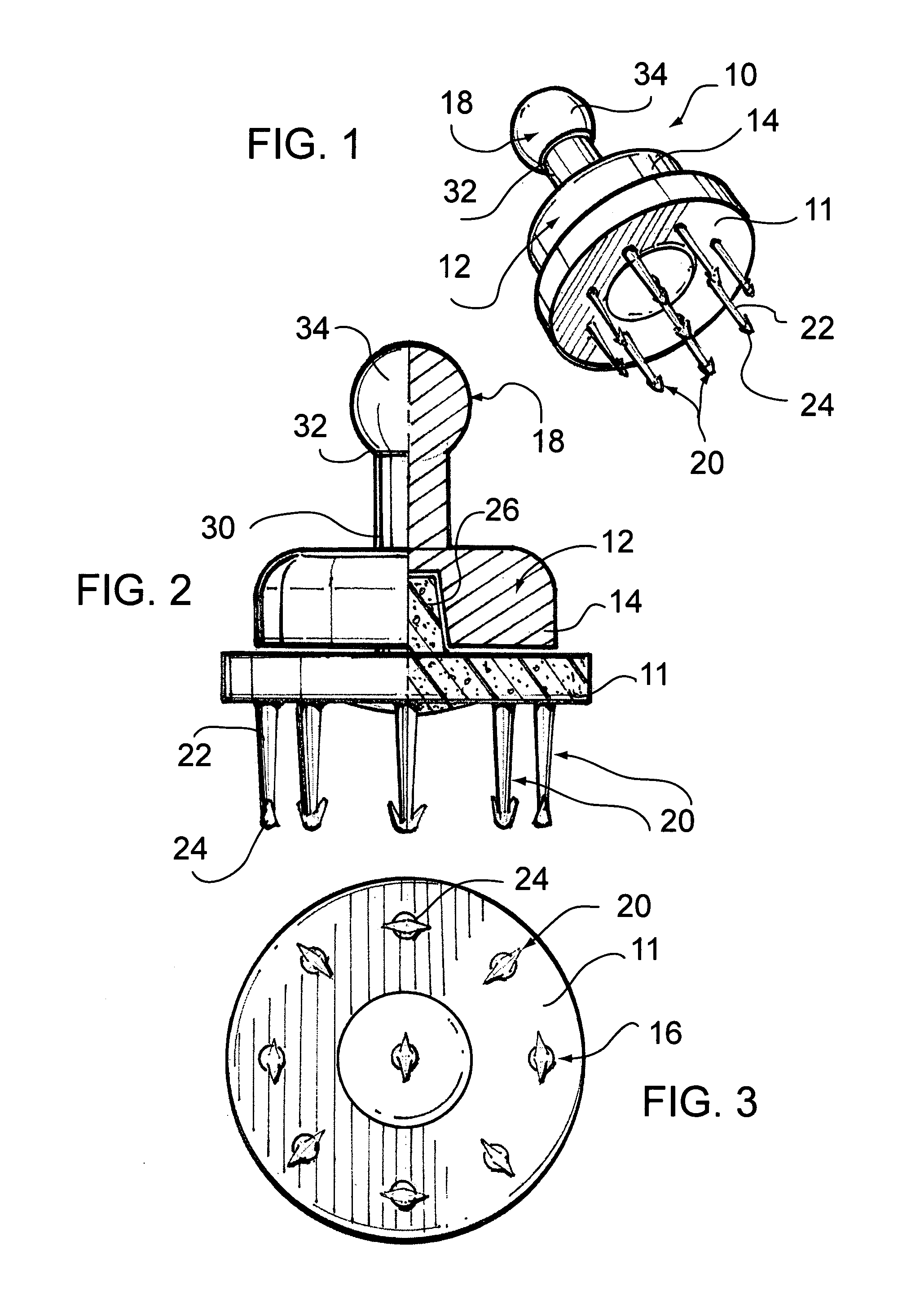 Apparatus and method for preventing fluid transfer between an oviduct and a uterine cavity