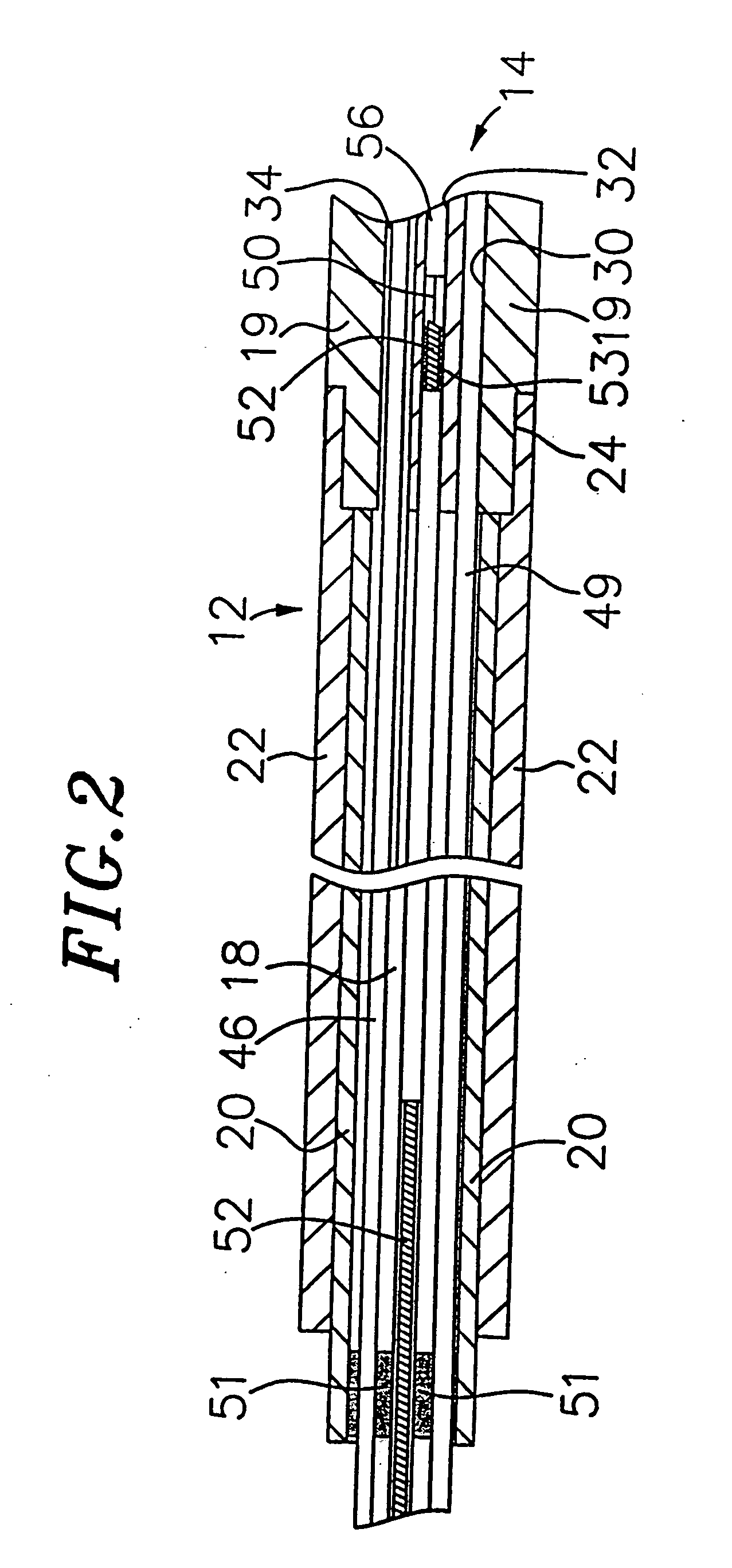 Irrigated catheter having a porous tip electrode