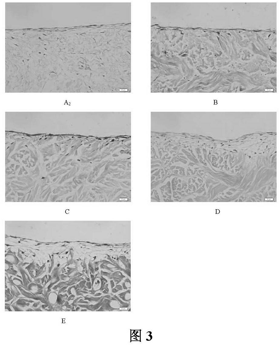 Method for preparing low-immunogenicity pig dermal support