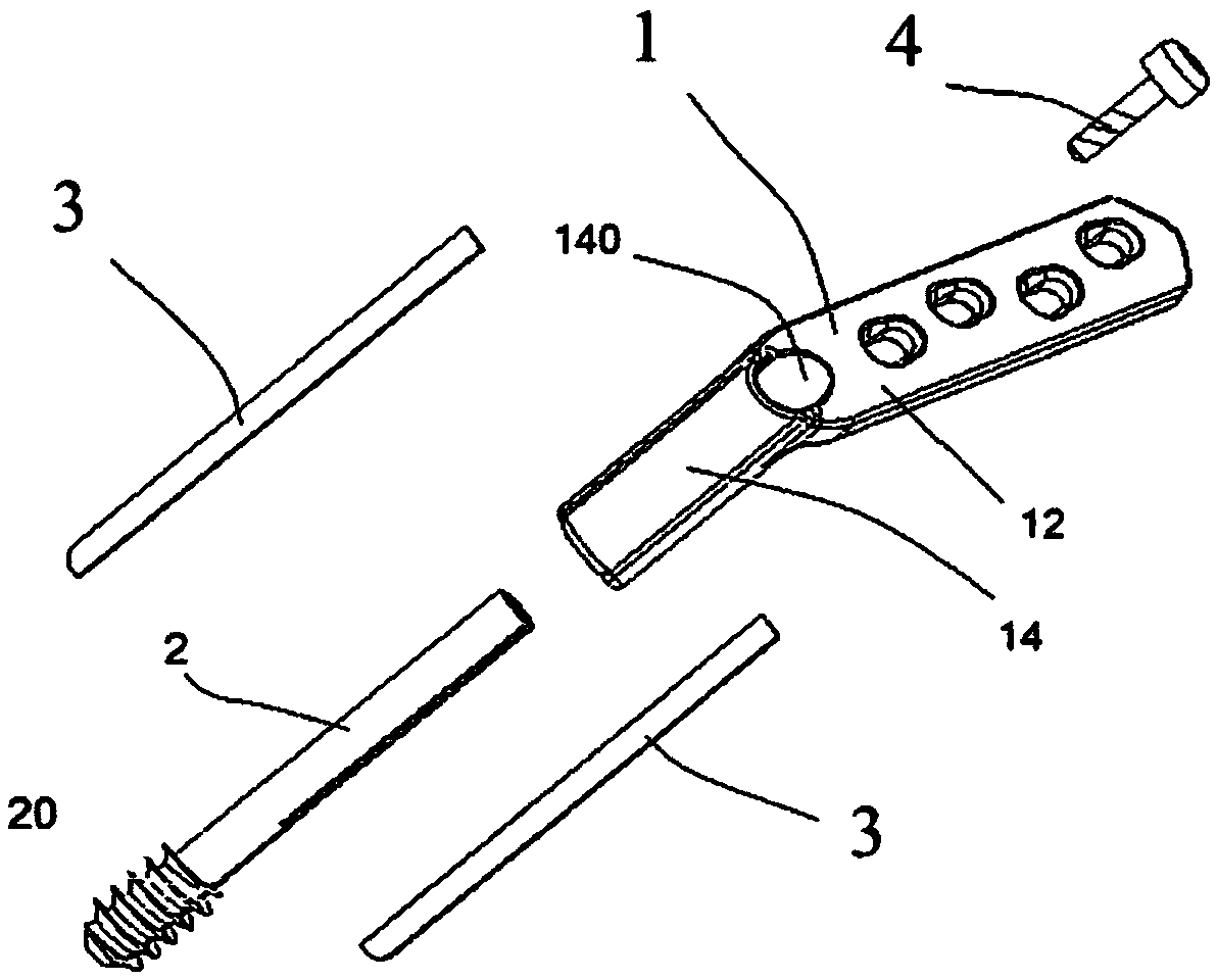 Bone screw and bone lamella structure