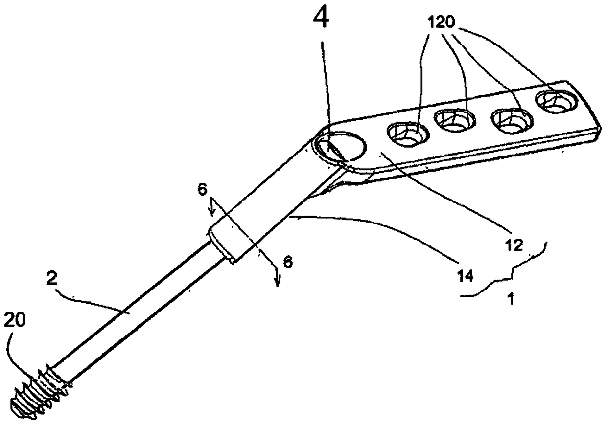 Bone screw and bone lamella structure