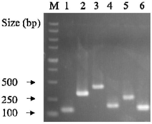 Primer set for quickly, qualitatively and quantitatively detecting six intestinal microorganisms and application thereof