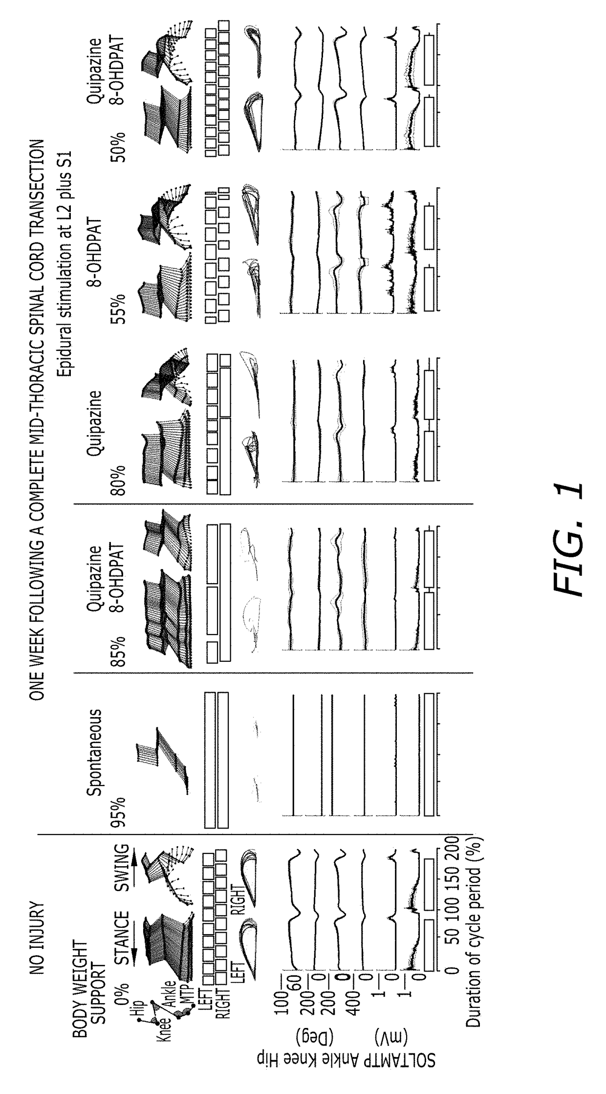 Epidural stimulation for facilitation of locomotion, posture, voluntary movement, and recovery of autonomic, sexual, vasomotor, and cognitive function after neurological injury