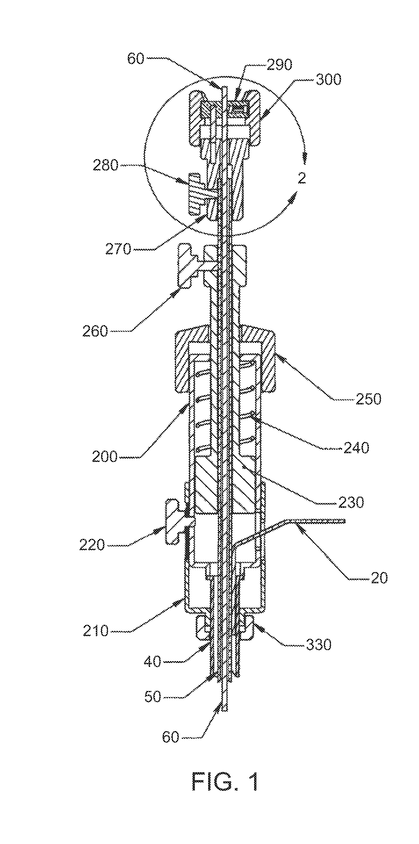 Luminal Structure Anchoring Devices and Methods