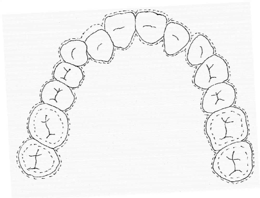 Aesthetic tooth socket, and preparation method and application thereof