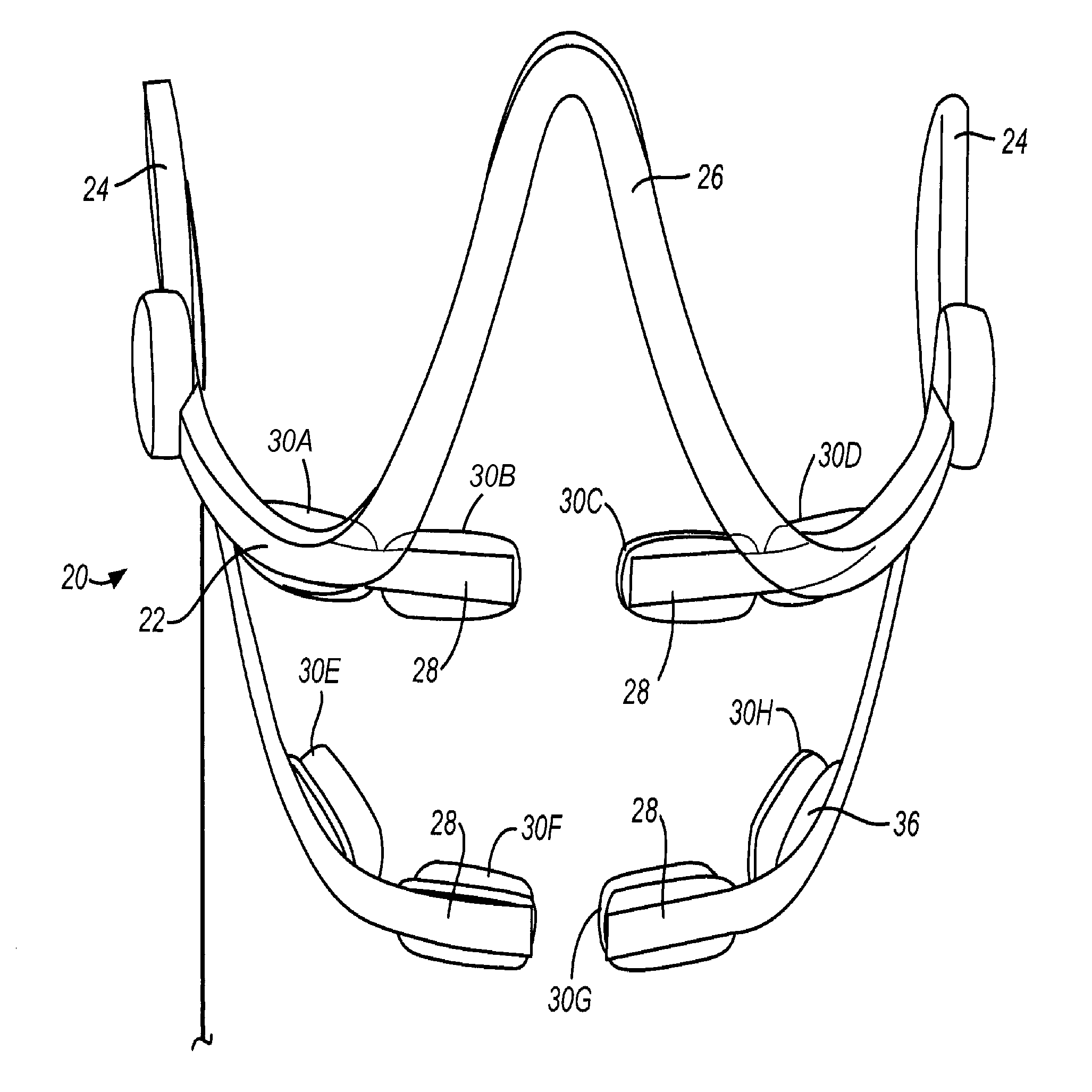 Methods and apparatuses useful for regulating bone remodeling or tooth movement using light therapy, a functional appliance, and/or vitamin d