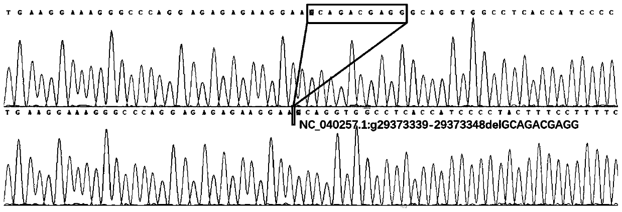 Primer pairs for detecting insertion/deletion polymorphism of sheep BMPR1B gene and kit, method and application