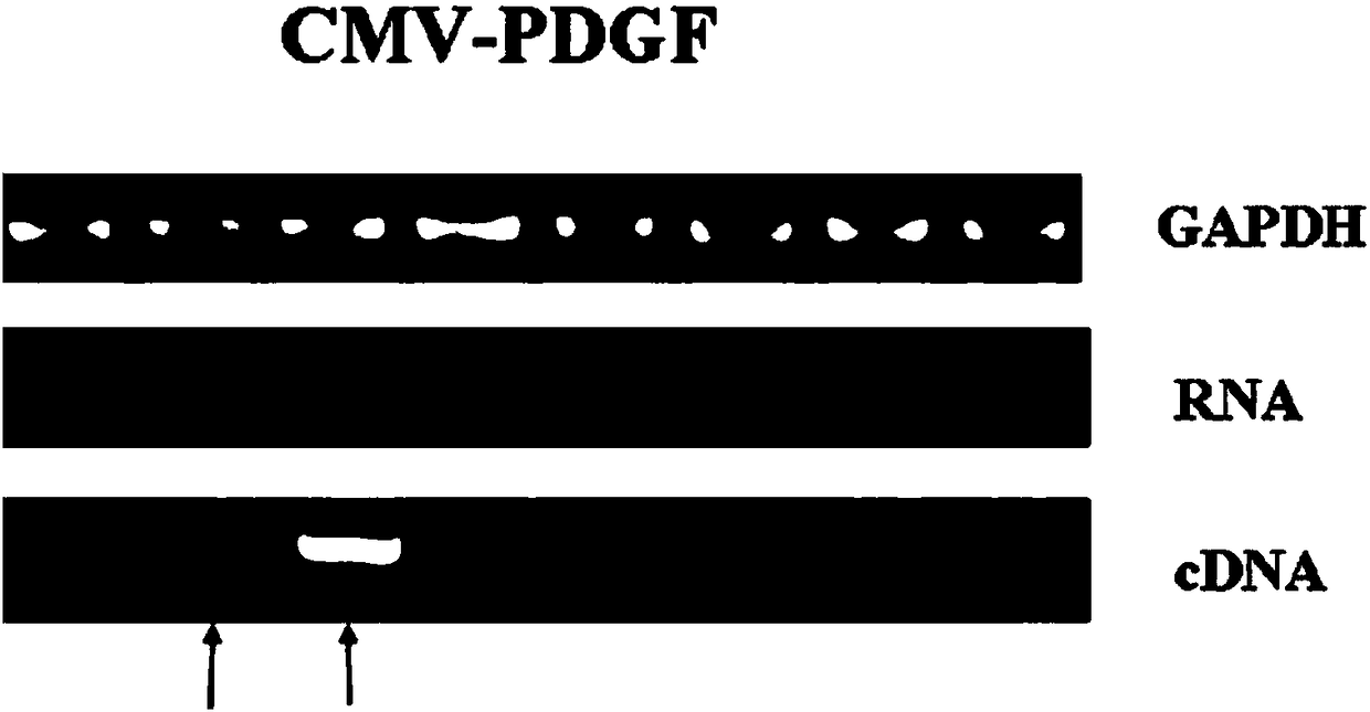 Construction method and application of PDGF-BB transgenic mouse spinal cord transaction model