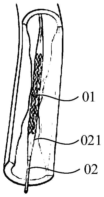 Blood vessel expansion equipment