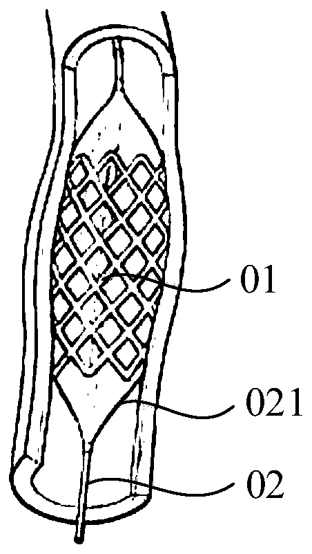 Blood vessel expansion equipment