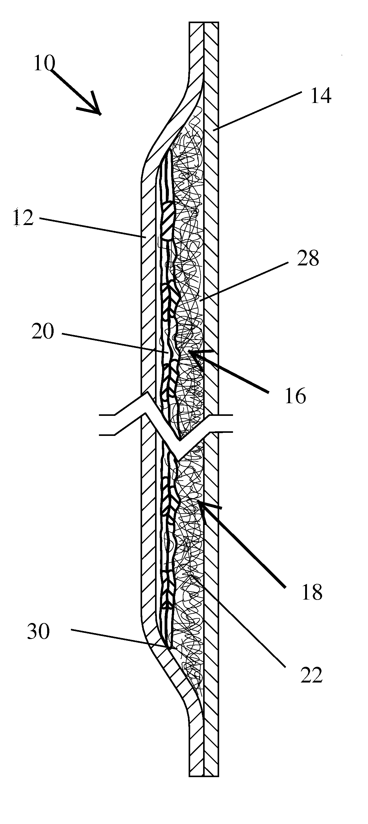 Heterogeneous mass containing foam