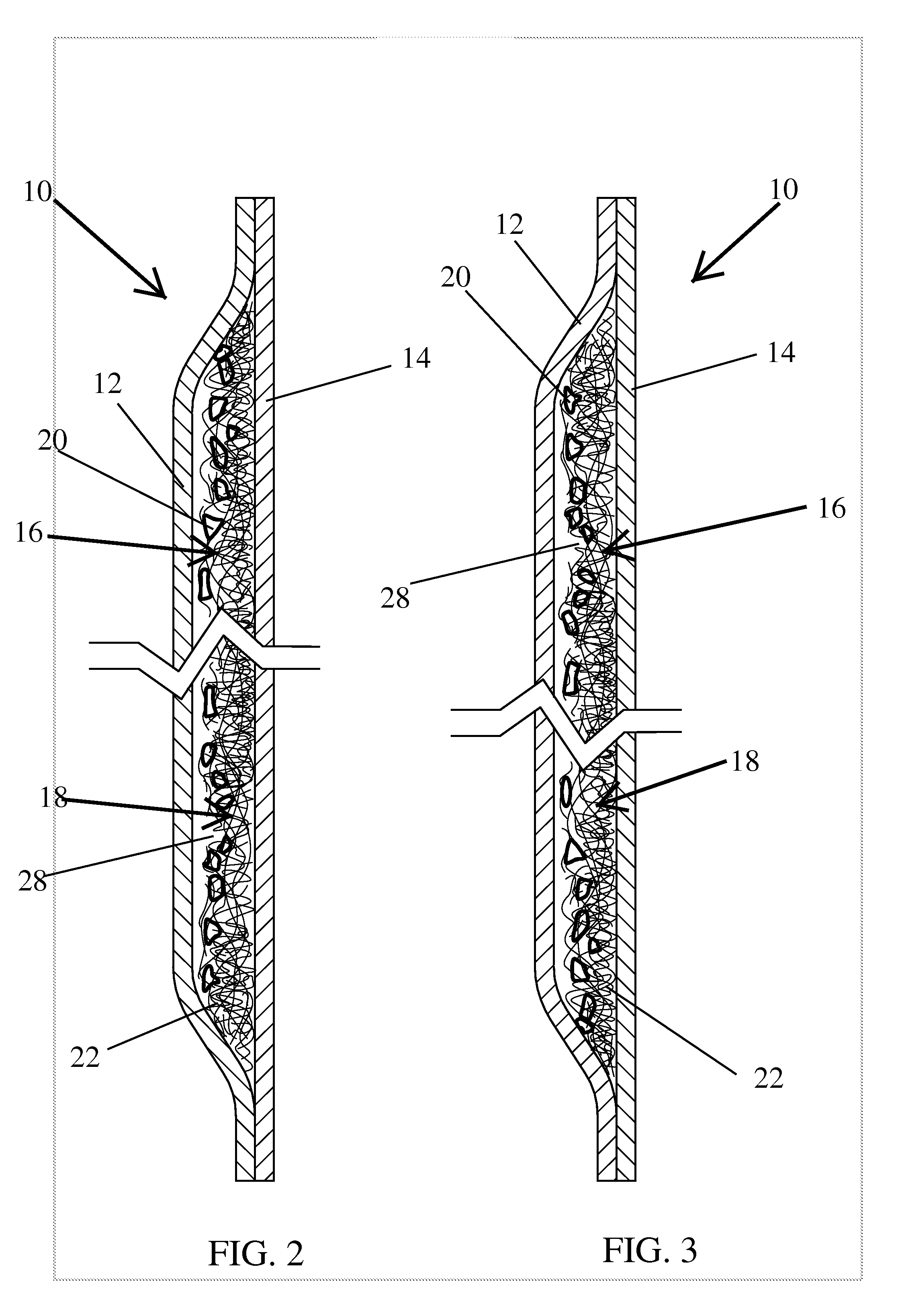 Heterogeneous mass containing foam