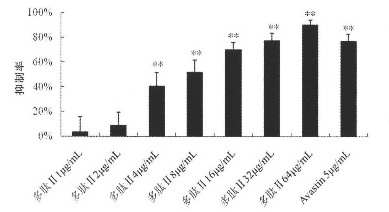 Application of integrin blocker in preparation of medicaments for treating ocular neovascular diseases