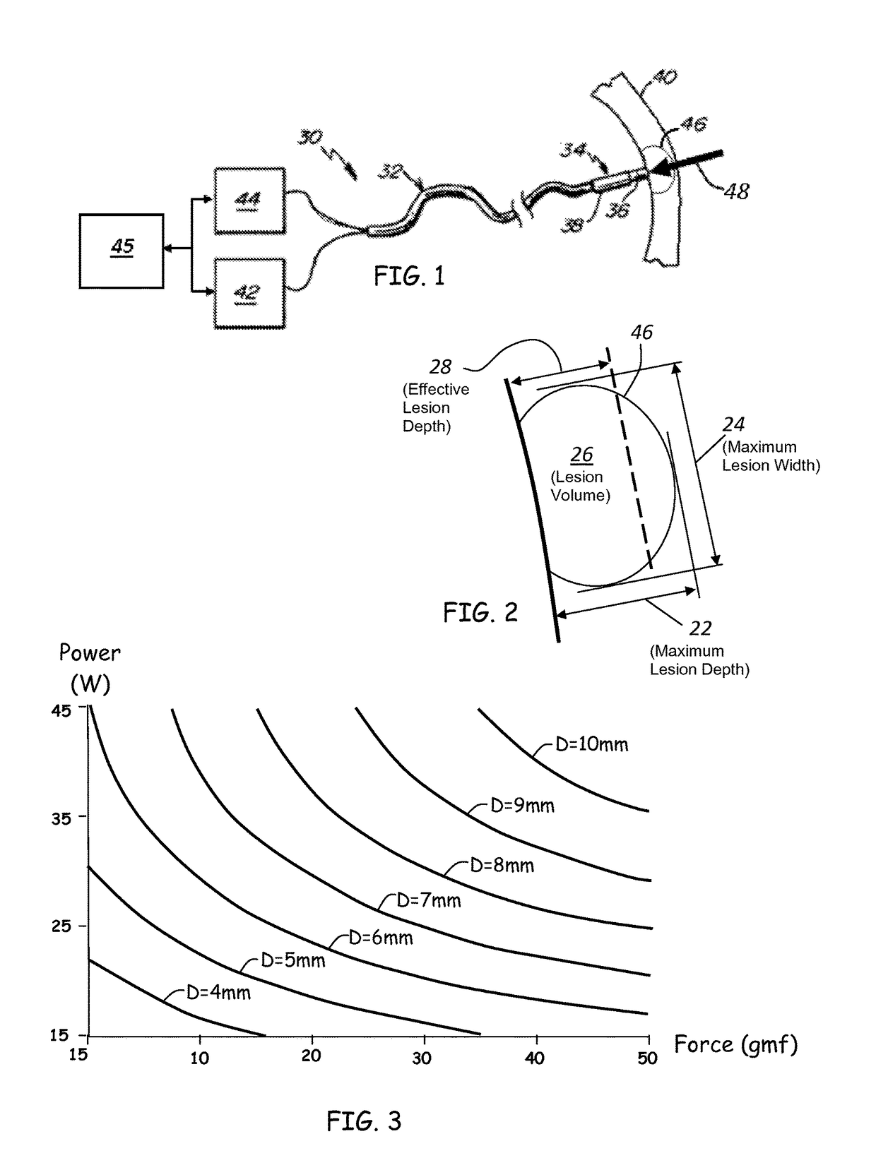 Prediction of atrial wall electrical reconnection based on contact force measured during RF ablation