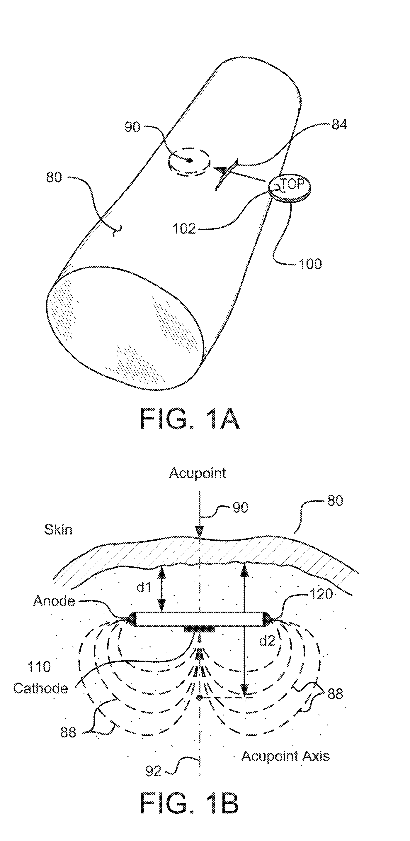 Methods and Systems for Treating Hypertension Using An Implantable Electroacupuncture Device