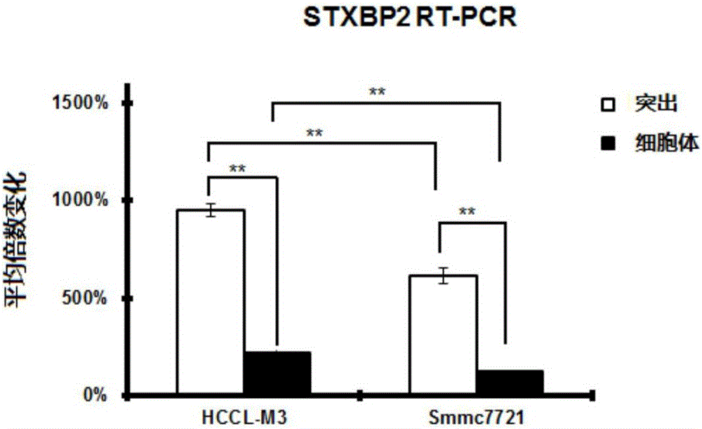 Reagent or kit for early diagnosis of hepatocellular carcinoma and application of reagent or kit