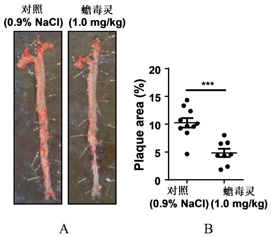 Application of bufalin in preparation of medicine for treating atherosclerosis