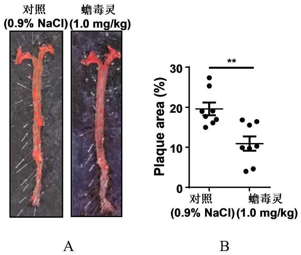 Application of bufalin in preparation of medicine for treating atherosclerosis